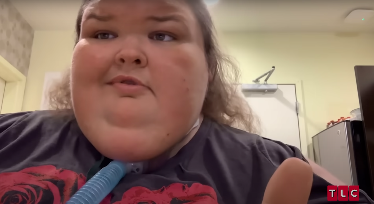 Tammy from '1000-lb Sisters' with a trach tube