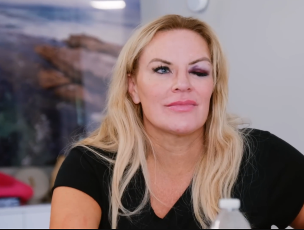 Heather Gay got a black eye while filming 'The Real Housewives of Salt Lake City' Season 3; how she got the black eye remains unclear