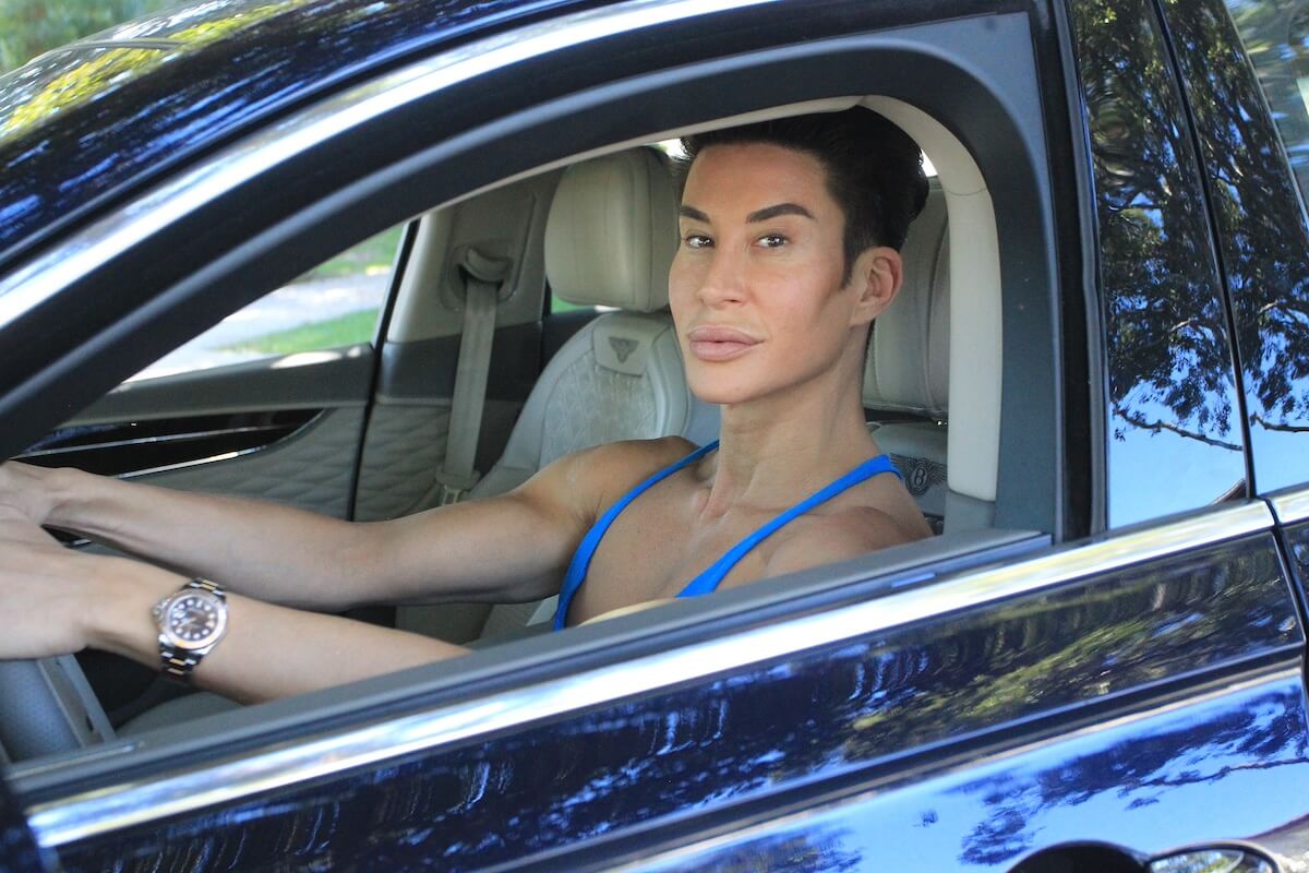 'Botched' patient Justin Jedlica sitting in a car
